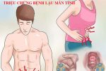 bệnh lậu mãn tính có chữa được không