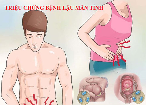 bệnh lậu mãn tính có chữa được không