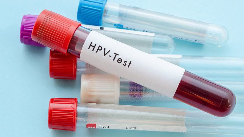 XÉT NGHIỆM HPV Ở ĐÂU UY TÍN HÀ NỘI