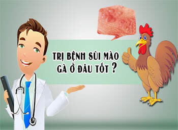 chữa bệnh sùi mào gà