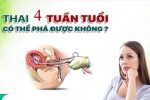 phá thai 4 tuần