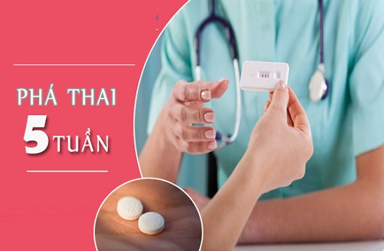 phá thai 5 tuần ở đâu uy tín hà nội
