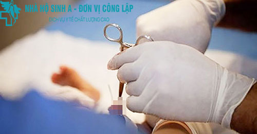 PHƯƠNG PHÁP CẮT BAO QUY ĐẦU CÔNG NGHỆ CHÂU ÂU THẨM MỸ CAO