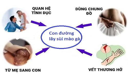 chữa sùi mào gà với bác sĩ giỏi