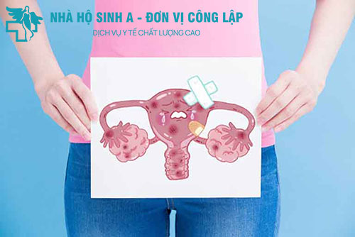 Tắc ống dẫn trứng nhiều nguy hại gặp phải