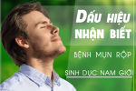 dấu hiệu mụn rộp sinh dục