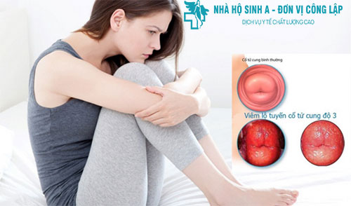 Viêm lộ tuyến cổ tử cung độ 3 – Điều trị sớm tránh nguy cơ vô sinh!