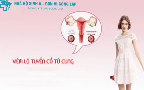 VIÊM LỘ TUYẾN CỔ TỬ CUNG ĐỘ 2 LÀ GÌ?