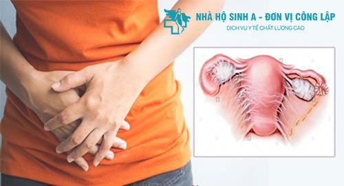 Viêm phần phụ là gì? Nguyên nhân, triệu chứng & cách chữa trị như thế nào?